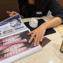 (주)포인트유브이임플란트 | 나의 두번째 임플란트 일기..with 서울루바브치과