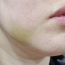 서울리안치과의원 이미지