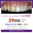 청담치과기공소 이미지