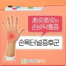 손목터널증후군 통증으로 병뚜껑 돌리기도 벅차, 마포구 공덕역 침치료 추천 한의원