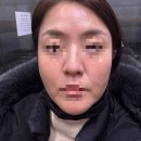 주흥11길 40 (1) | 40대 내돈내산 피부관리 1차,제네시스 레이져 토닝 &amp; 비타민&amp;수분 관리 후기