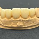 디지털(DIGITAL) 치과기공소 이미지