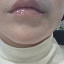 바이오플러스(주) | [피부] 바이오플러스 스킨부스터 '휴그로' 가격·장점