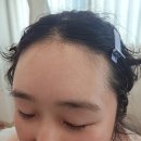 왕방로 | 포천왁싱샵 누본왁싱 | 저자극 슈가링 페이스왁싱(헤어라인+이마) 후기