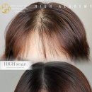 스칼프K 이미지