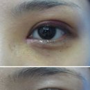 아름다운성형외과 - 춘천시 터미널길 21 | 아름다운성형외과