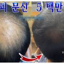 풍성풍성두피