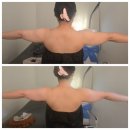 부천팔뚝관리 벨레나뷰티에서 상체라인 관리받은 후기