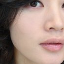 태양피부관리 이미지