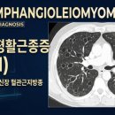호흡 곤란을 겪는 40대 초반 여성-림프관평활근종증(Lymphangioleiomyomatosis, LAM) 이미지