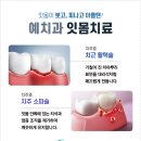 이천예치과의원 네이버블로그
