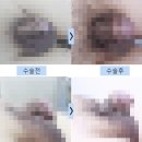 영광비뇨기과의원 | 남성확대수술 후기 많은 곳? 그보다 더 중요한 기준 1가지