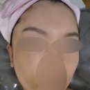 죽전 건강드림약국 | 수지 피부관리샵 올가드림뷰티 죽전점 모공관리 받고 모낭충 박멸 후기