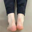 서혜진 | 충정로 필라테스｜신규 선생님 1:1 수업 후기 (골반 정렬 변화 사진 포함)