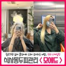 모에드헤어 | 식사동두피관리 모에드에서 두피 스케일링 받고 탈모 걱정 털어내요, feat.붙임머리 오래 유지하는 방법