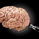 노인치매센터 이미지