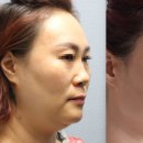 스킨영의원 이미지