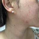 플라워솜 - 군포시 산본로249번길 11 | 약산성토너 추천! 스킨쎌 스노우플라워 토너 후기