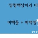 양평백상치과 미백후기입니다 ^^