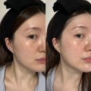 (주)에이치비플러스 | [내돈내산]홈모드써마리프트 솔직후기 (8주차) 홈모드스킨부스터 피부과 왜가요..?