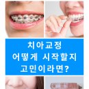 에이플란트치과의원 이미지