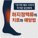 하지정맥류의 치료와 예방 | “걷기만 해도 다리가 무거운 당신에게” 하지정맥류의 치료와 예방법