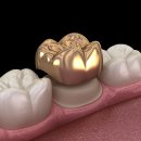 크라운사거리 이미지