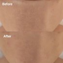 약초이야기 | 천안 피부관리 추천ㅣ약초 소프트필링 후기 &#34;이정희스킨케어&#34;