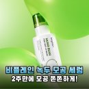 조이광고기획 | 2주 만에 모공 고민 끝! 비플레인 녹두 세럼 솔직 후기