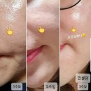 인셀덤발라또그룹