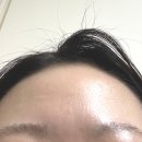 에스시디기획 | 모낭염 좁쌀여드름 내돈내산 공병템 추천 N통 쓰고 효과 본 제품 (골드PTT 이후 세럼 수분크림 에스로반...