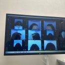 모앤블레스의원 | [웨딩 두피 관리] 모앤블레스 웨딩 두피&amp;피부 케어 후기