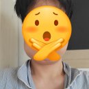 이조은치과의원 | [대전] 자양동 치과 이조은치과의원 사랑니 발치 후기