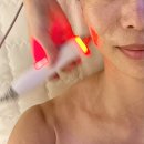 알찬슈퍼 | [도봉구 피부관리] 1회만 받아도 달라진 윤곽 (소원뷰티 슈퍼 리프팅 후기)