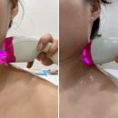 창원의료기 | 창원 도계동 ✨바디닥터✨ 고주파 얼굴관리 후기 창원가정용의료기
