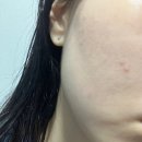 신갈우체국 | 청소년여드름화장품 더순수 AC컨트롤 여드름토너