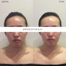 설아미 | 의정부피부관리 설아미 의정부본점에서 경험하는 맞춤 케어