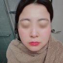 이기영 | 천년초 이기영 피부사랑비누 잇몸사랑 치약 세트 사용후기