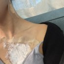 스마트의원 | [타투제거 1-2회차] 잠실 스마트의원 후기