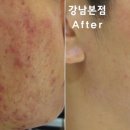 리유 이미지