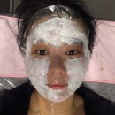 샤인약국 | [서현역 피부과] 내돈내산 리쥬베룩 4cc 후기+ 더마샤인/ 다운타임, 리쥬란 경과