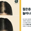 모먼트(MOMENT) 이미지