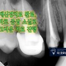 더굿모닝치과의원 네이버블로그