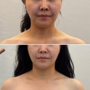 백의민족 | 미사피부관리 백의민족피부 탄력관리 후기