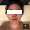 두손에스테틱 | 루아흐에스테틱 수기로 관리해주는 윤곽관리 맛집 청라에스테틱