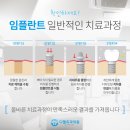 디엘치과의원 네이버블로그