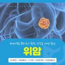 메트로내과의원 | 신천동내과 위암 위내시경을 통한 조기 발견, 건강을 지키는 열쇠