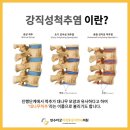 모래내정형외과의원 네이버블로그