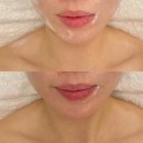 매일엘피지 | 파주 운정피부관리 엘피지오 스타필드빌리지 운정점 방문 후기