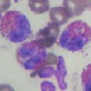 호산육종 이미지